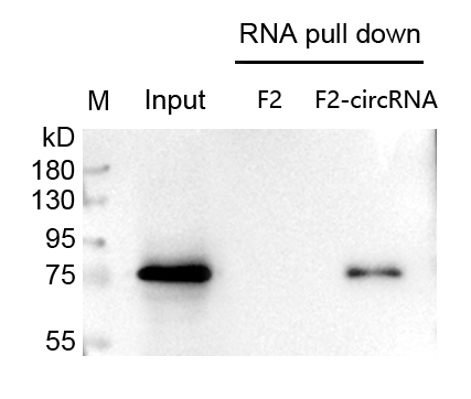 1689558828167780.jpg circRNA pull down wb檢測圖.jpg
